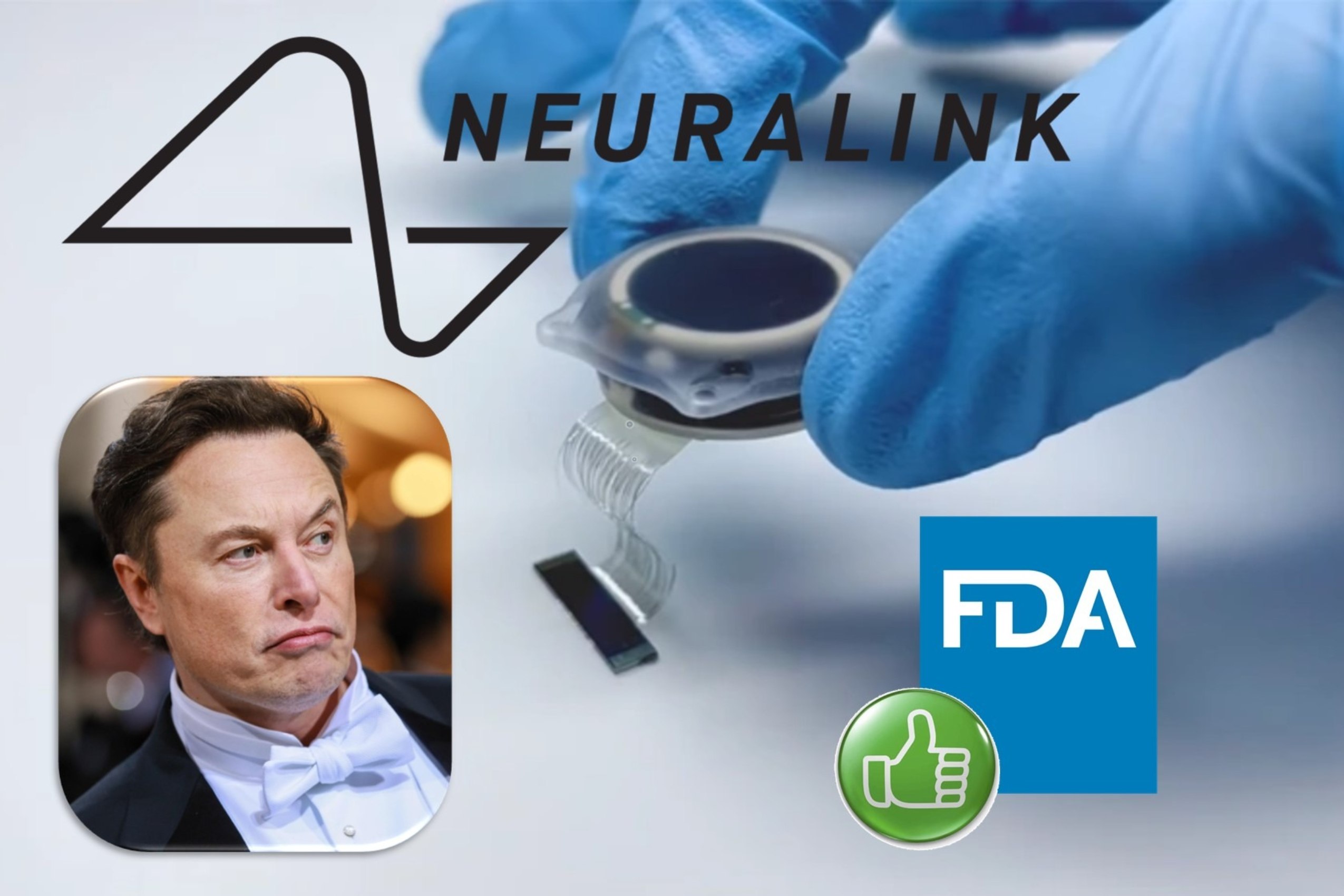 Elon Musk agyi implantátum startupja megkapta FDA jóváhagyást az emberi kísérletekhez
